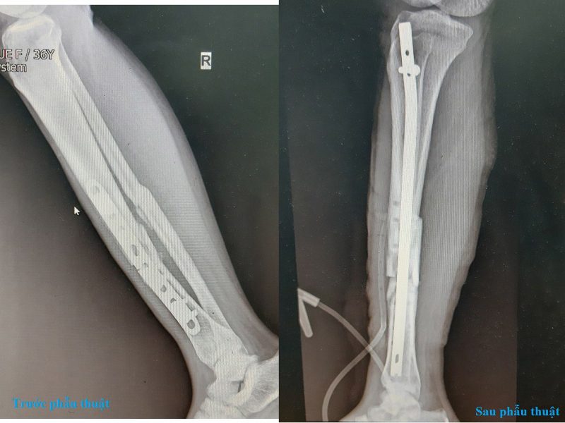 22012020 PTC 1