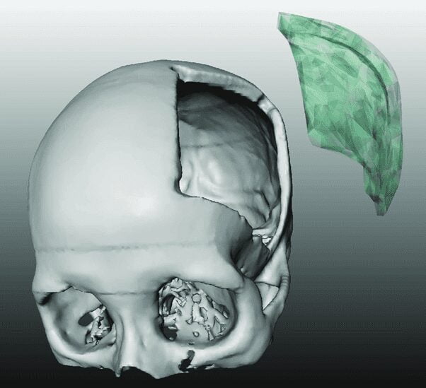 Mô hình giải phẫu hộp sọ và não người