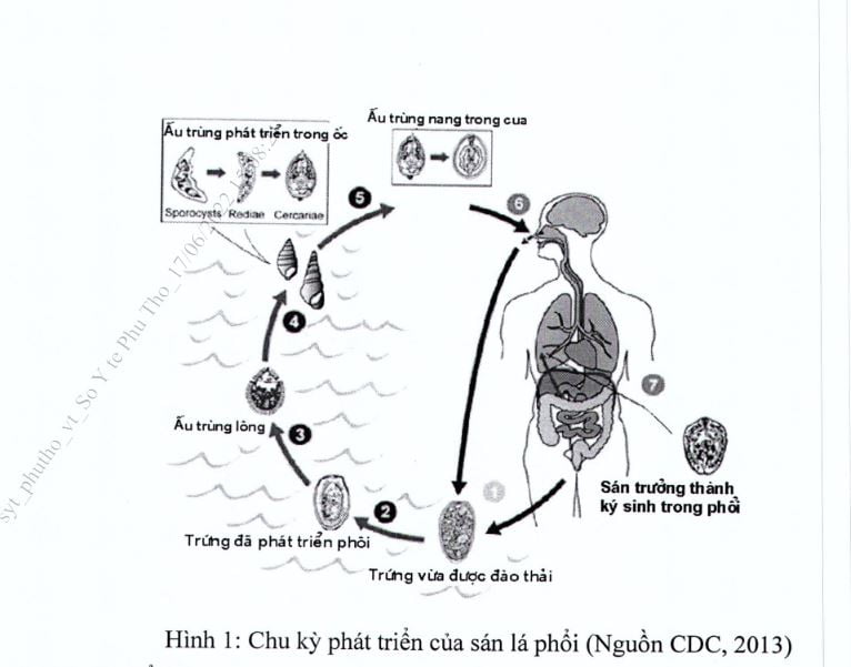 Trực quan quá trình tàn phá lá phổi của khói thuốc lá  Báo Dân trí