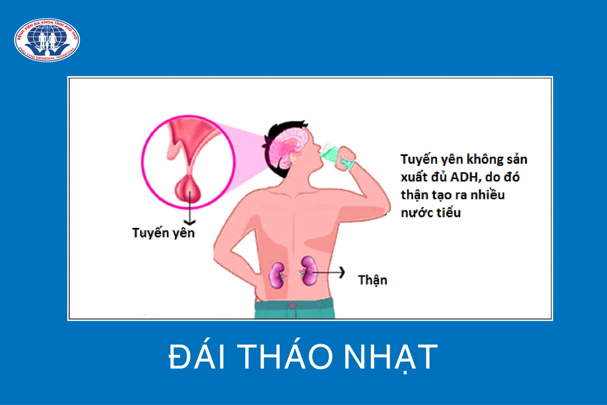 Khi thấy xuất hiện những triệu chứng của bệnh đái tháo nhạt, người bệnh nên sớm đi thăm khám để được chẩn đoán và điều trị kịp thời.
