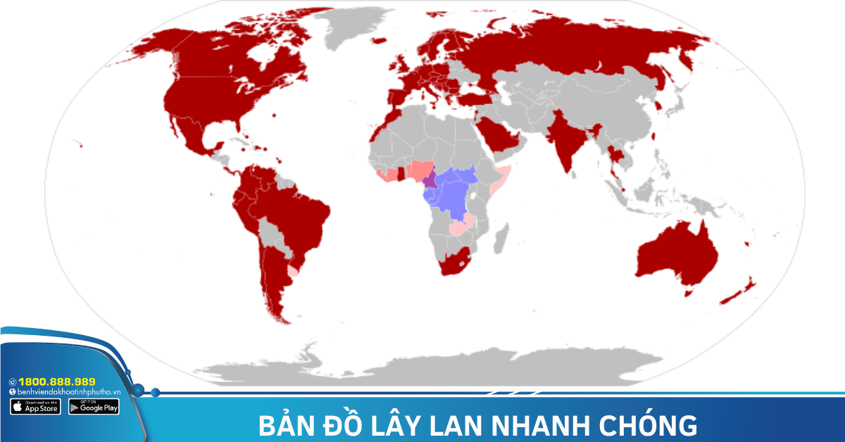 5 điều cần biết về bệnh đậu mùa khỉ 2 Bản đồ lây lan đậu mùa khỉ