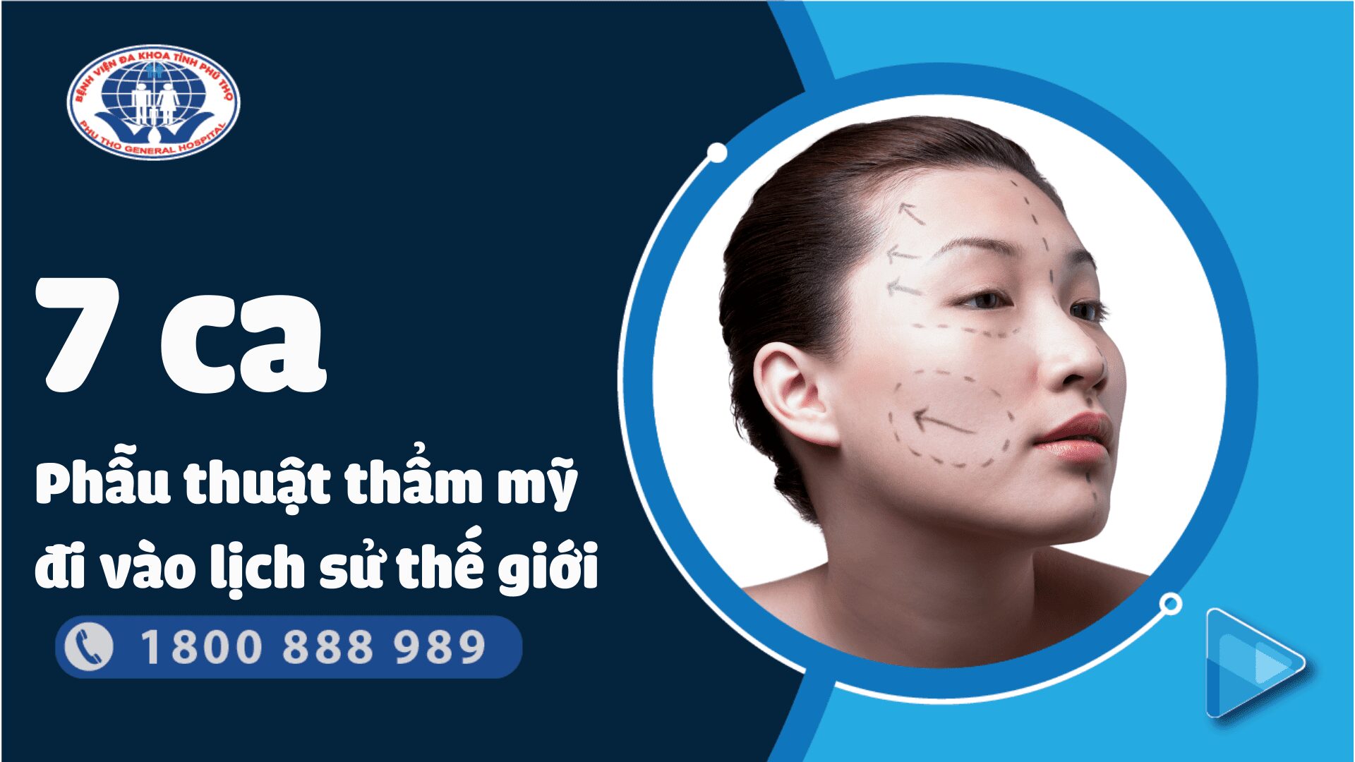 7 ca phẫu thuật thẩm mỹ di vào lịch sử thể giới