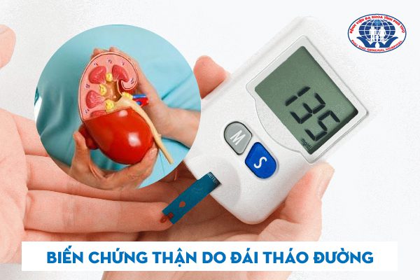 BIẾN CHỨNG THẬN DO ĐÁI THÁO ĐƯỜNG – 6 ĐIỀU NGƯỜI BỆNH PHẢI CHÚ Ý 2 Biến chứng thận do đái tháo đường là gì?