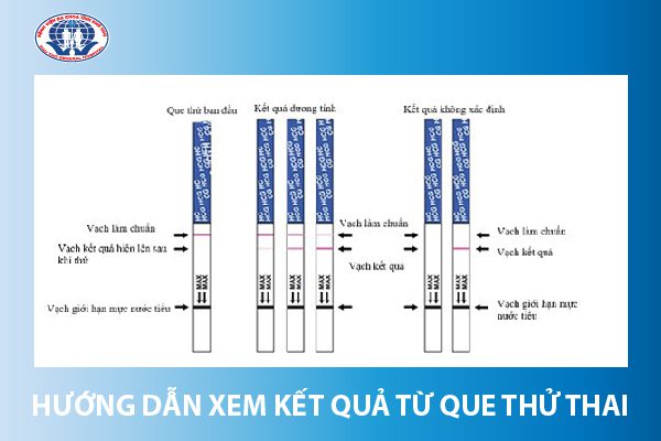 Biết mình mang thai bằng cách nào? Chỉ cho bạn 1 cách đơn giản tại nhà. 2 Dùng que thử thai để xác định mang thai hay không