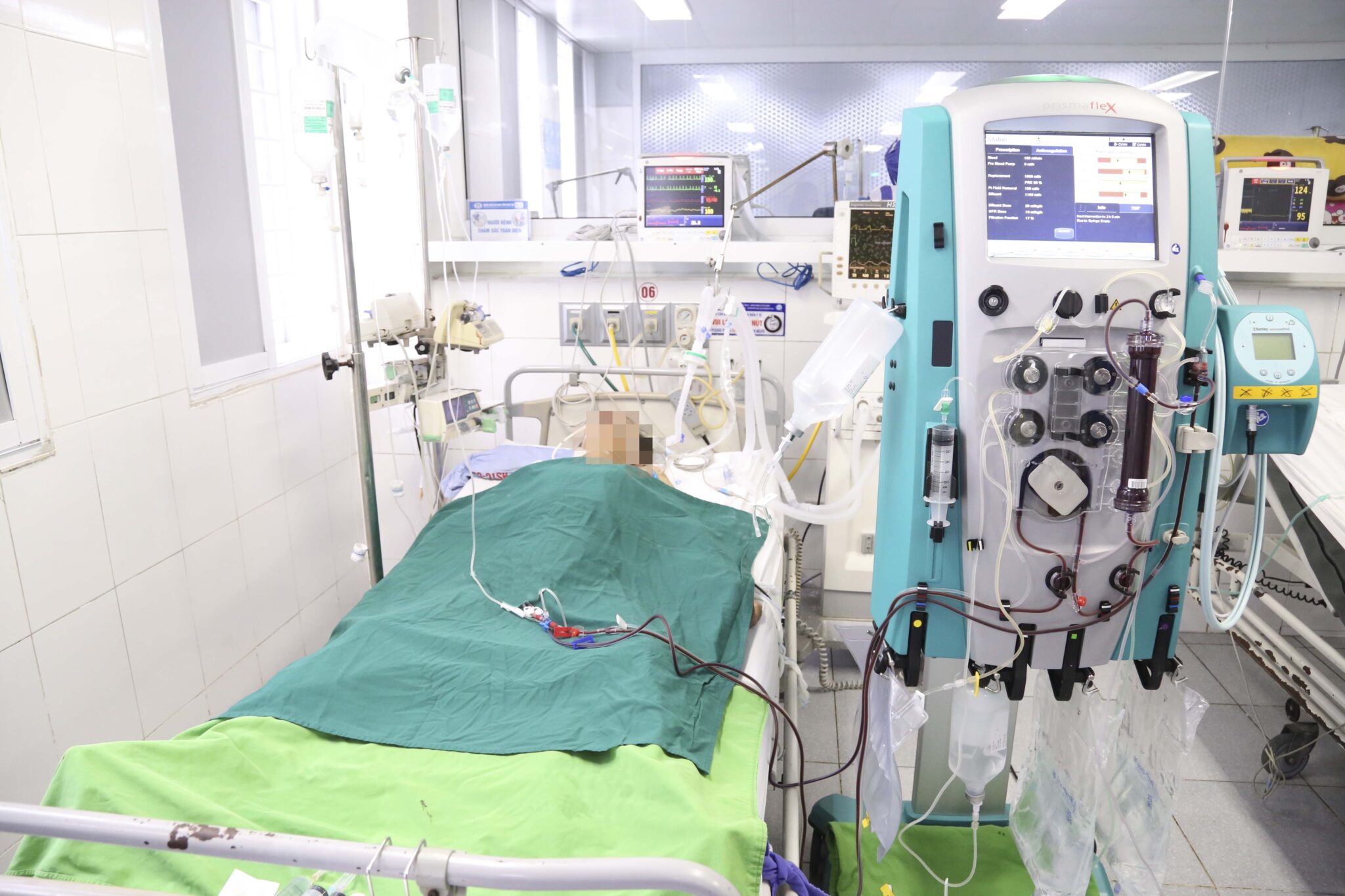 Cứu sống 1 người bệnh nguy kịch sốc tim do nhồi máu cơ tim 1 Người bệnh sốc tim được điều trị tại Khoa HSTC
