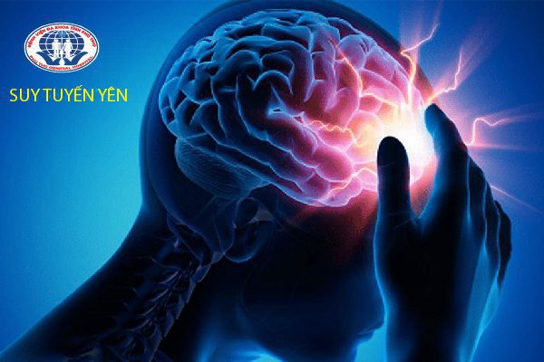Suy tuyến yên - 5 điều cần biết để phòng tránh