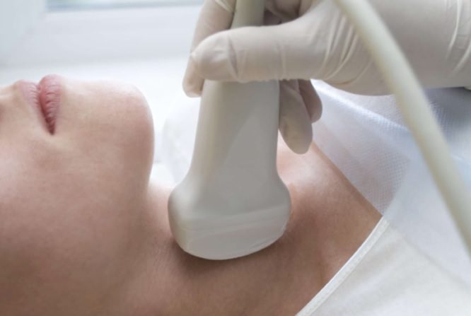 Bệnh viêm tuyến giáp bán cấp có chữa khỏi được không? (ảnh st)
