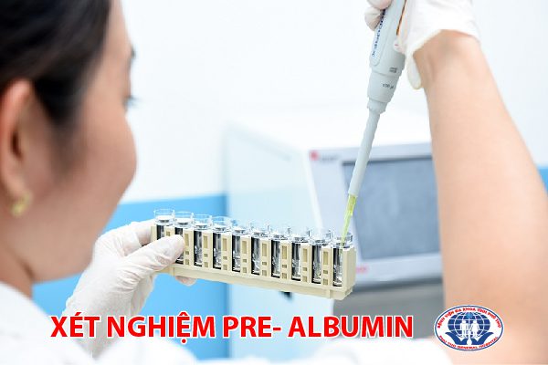 Xét nghiệm Pre- albumin