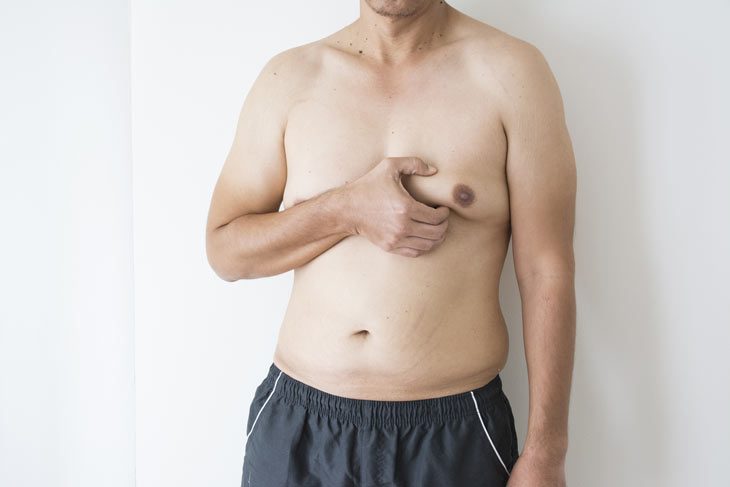 Cách điều trị chứng vú to ở đàn ông 