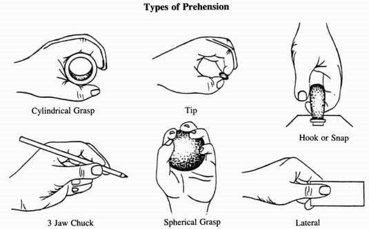 Hoạt động trị liệu tại Trung tâm Đột quỵ Phú Thọ có gì đặc biệt? 5 Các kiểu cầm nắm cần can thiệp