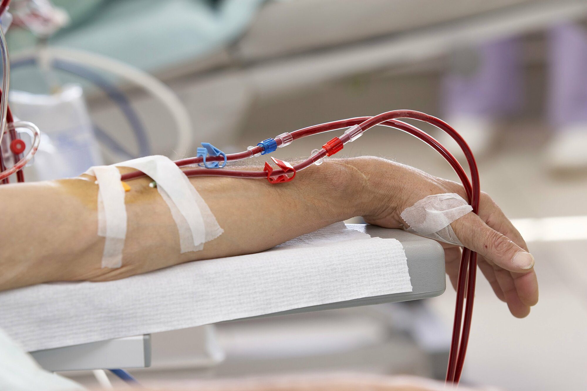 Hình ảnh 2: Điều trị truyền máu cho bệnh nhân thiếu máu thiếu máu