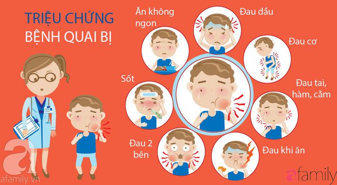 Bệnh quai bị - Nguyên nhân, triệu chứng, cách phòng ngừa 2 Triệu chứng bệnh quai bị