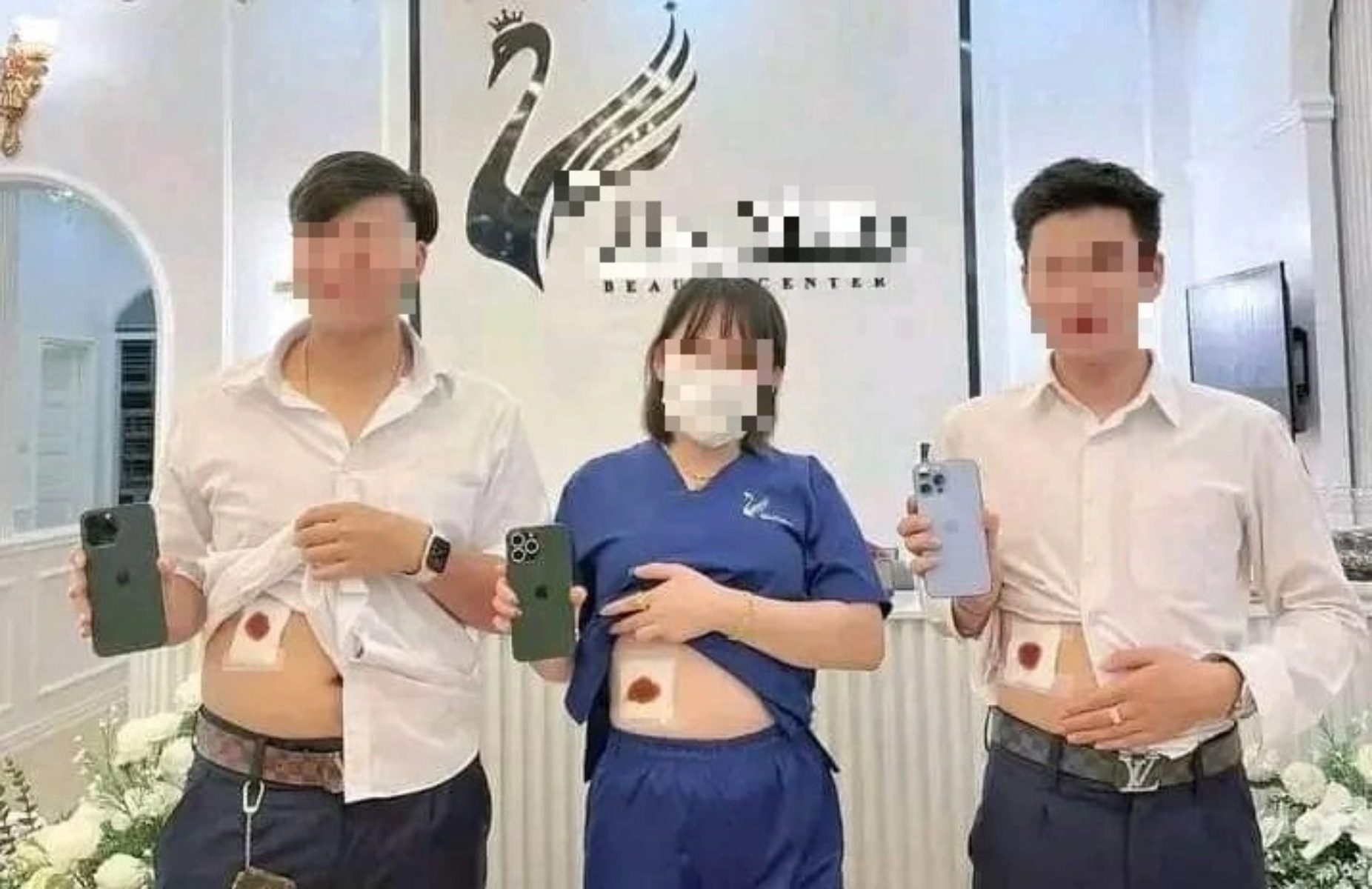 Đổi thận lấy iphone