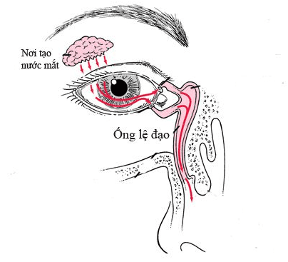 Có những biến chứng gì có thể xảy ra nếu không điều trị viêm tuyến lệ cho trẻ em?
