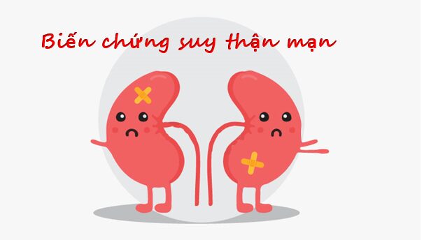 10 biến chứng ở bệnh nhân suy thận mạn 1 biến chứng suy thận mạn