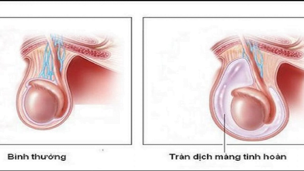 22022023 trandichmangtinhhoan 1