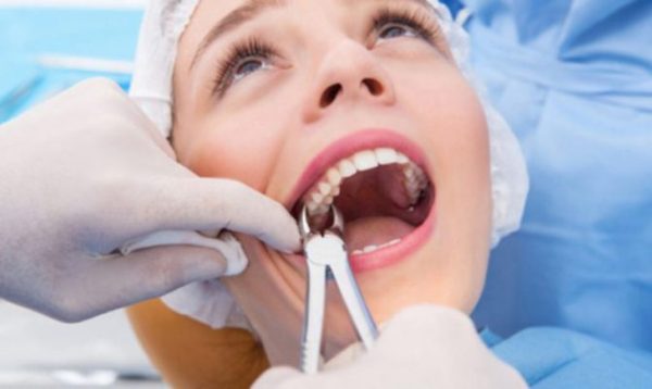 Nên nhổ răng khôn khi răng khôn mọc gây các biến chứng đau, u nang, nhiễm trùng lặp đi lặp lại, ảnh hưởng đến các răng lân cận