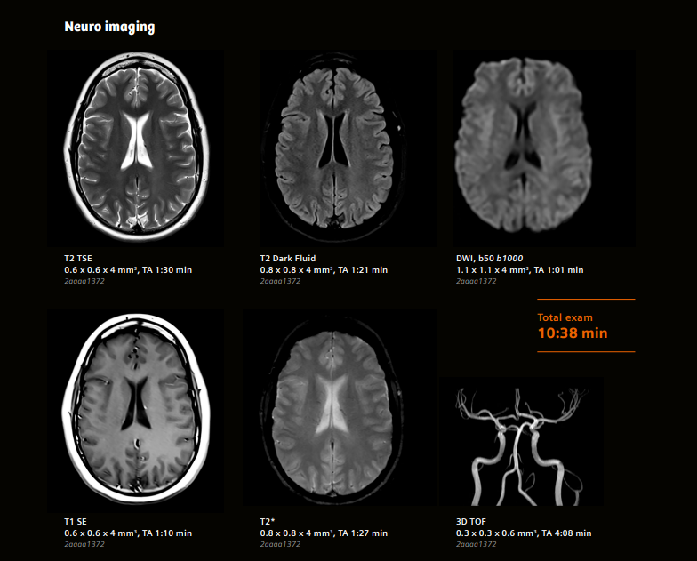 Hình ảnh cộng hưởng từ 3.0T sọ não đánh giá các cấu trúc não và mạch não