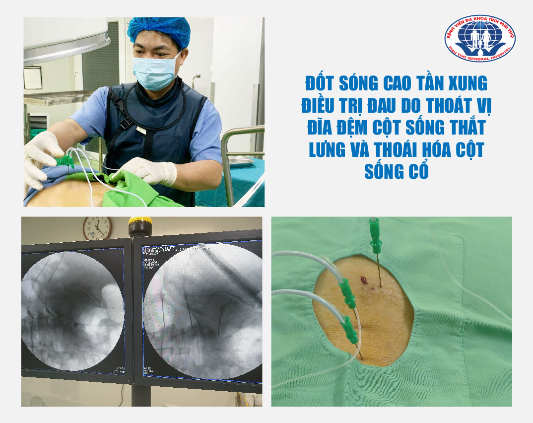 TS.BS Vi Trường Sơn – Trưởng khoa Ngoại yêu cầu điều trị đau bằng phương pháp Đốt sóng cao tần xung cho 2 mẹ con người bệnh