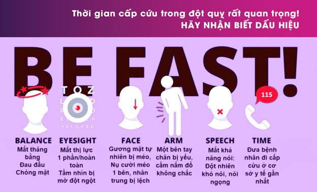 nhìn mờ dấu hiệu đột quỵ