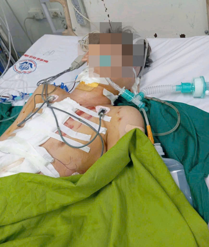Người bệnh được điều trị tại khoa Hồi sức tích cực – Chống độc sau khi phẫu thuật 