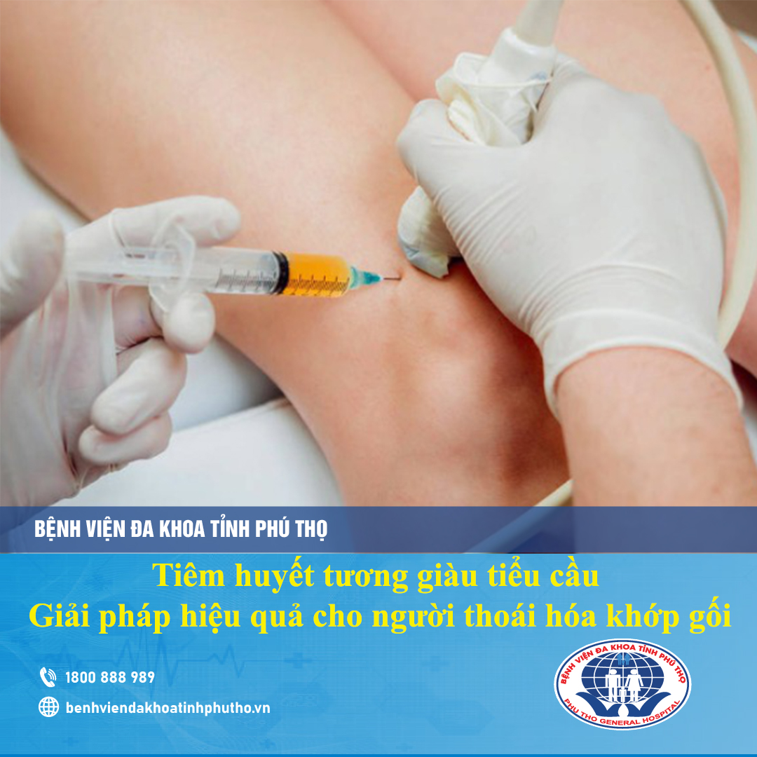 Tiêm huyết tương giàu tiểu cầu – Giải pháp hiệu quả cho người thoái hóa khớp gối