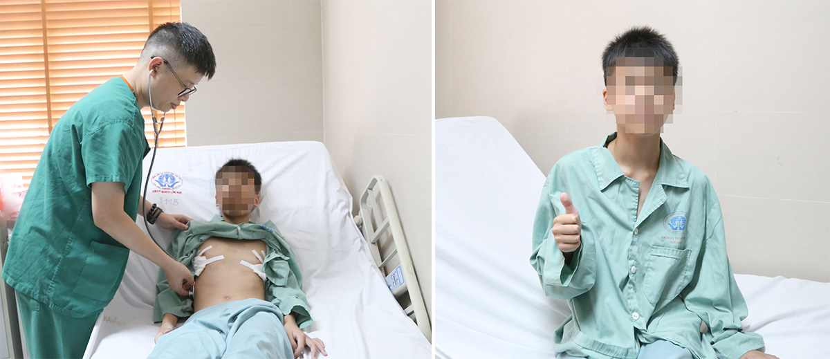 Ngực lồi lên như ức gà, cậu bé 12 tuổi thay đổi ngoại hình ngoạn mục sau khi đến Bệnh viện Đa khoa tỉnh Phú Thọ