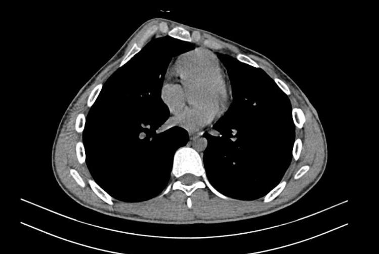 uc loi 3 1