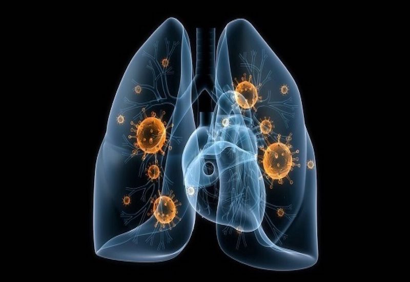 Hình minh họa: Virus hoặc vi khuẩn là nguyên nhân gây nên các bệnh hô hấp thường gặp khi giao mùa