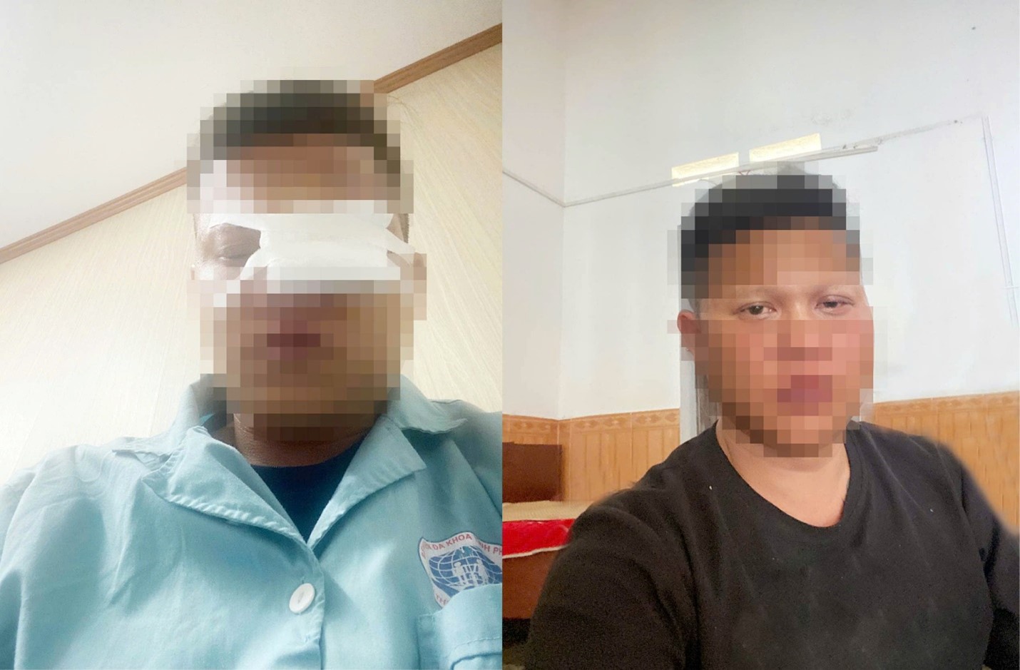 Bỏng nặng, tổn thương mắt vì bình gas mini: Đừng để bữa ăn ngày tụ họp kết thúc trong phòng cấp cứu