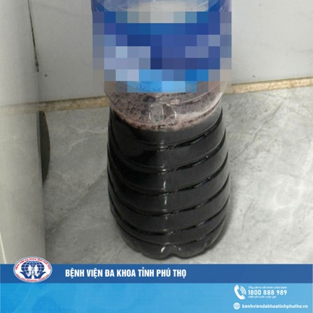 Cảnh báo: Bé trai 13 tuổi bị tan máu cấp sau khi dùng lá lộc mại chữa táo bón 8 tan mau cap khi dung la loc mai chua tao bon 2