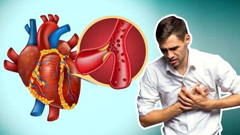 Giờ vàng trong cấp cứu nhồi máu cơ tim: Ranh giới sinh tử bạn cần lưu ý 4 Giờ vàng trong cấp cứu nhồi máu cơ tim