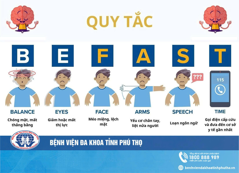 Đột quỵ có dấu hiệu gì? Nhận biết sớm để không bỏ lỡ "thời gian vàng" 5 dau hieu cua dot quy 2