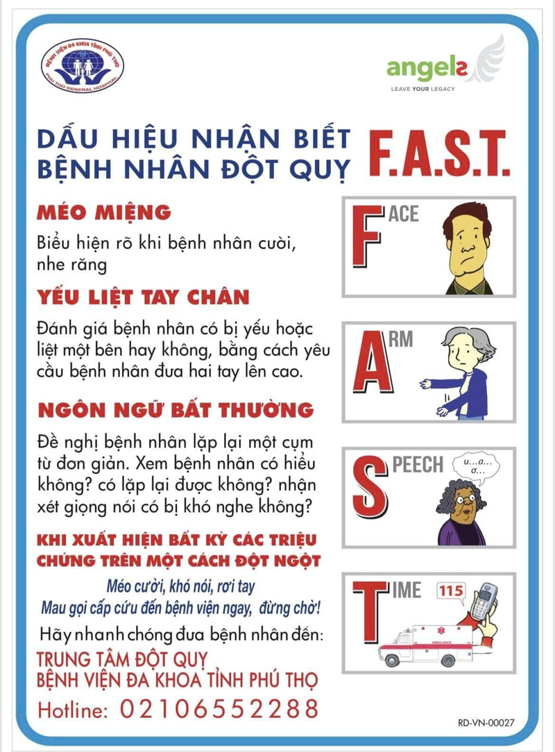 Đột quỵ có dấu hiệu gì? Nhận biết sớm để không bỏ lỡ "thời gian vàng" 6 dau hieu cua dot quy 3