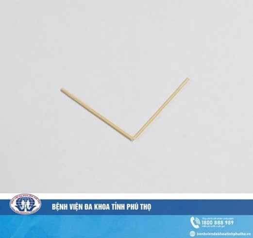 Thủng ruột do tăm tre – Nguy hiểm từ một dị vật nhỏ 4 Thủng ruột do tăm tre