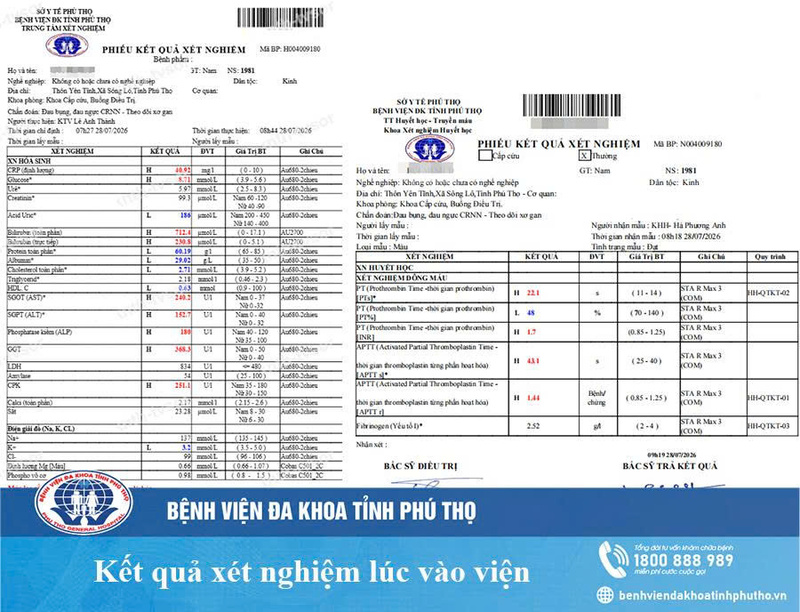 tổn thương gan nghi do thuốc nam không rõ nguồn gốc